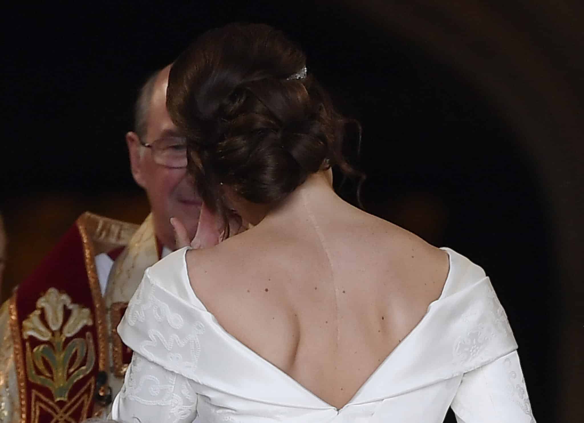 Prinzessin Eugenie spricht über ihre Erkrankung